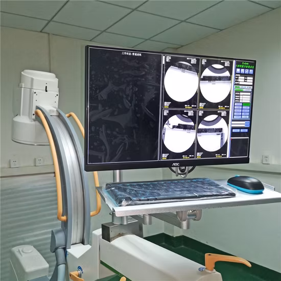 Хирургическая мобильная рентгеноскопия Рентгеновский аппарат С-дуги на продажу